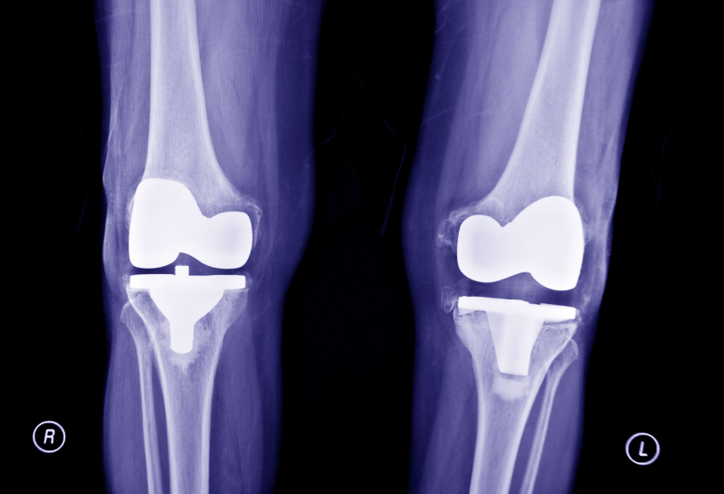 d7ff0befb04d43f8867cdca424d9f451 (1)